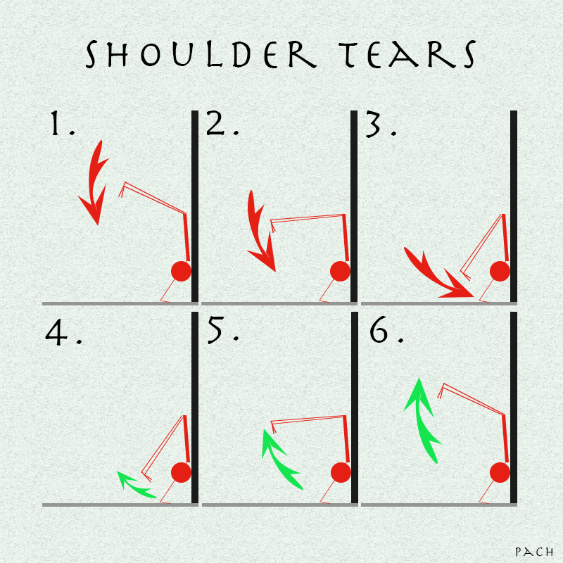 shoulder tears
